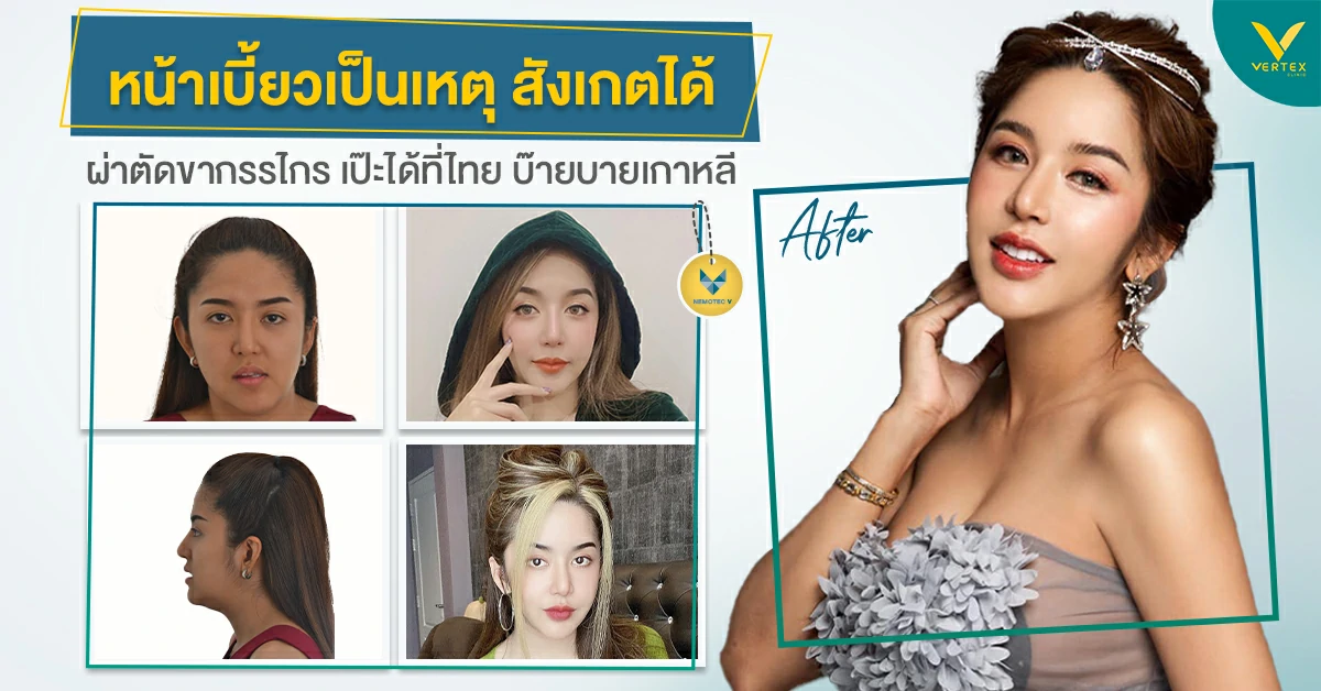 คุณนัส ผ่าขากรรไกร