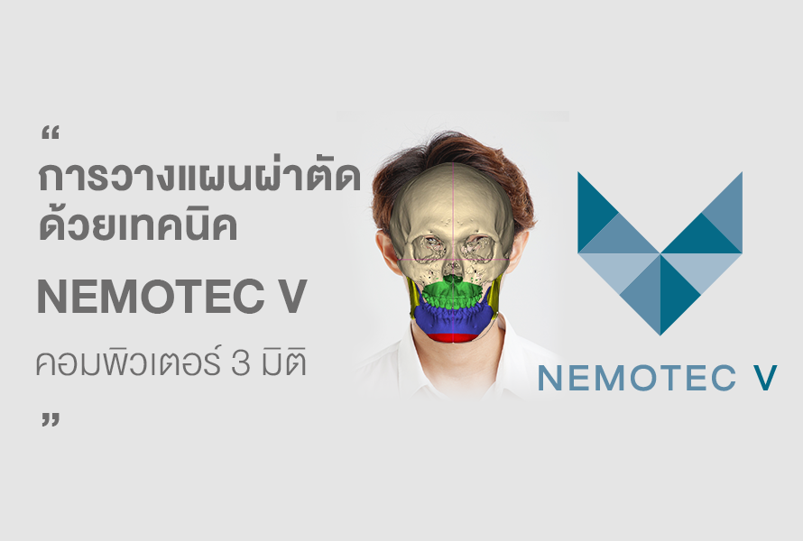 ผ่าตัดขากรรไกร-การวางแผนผ่าตัด