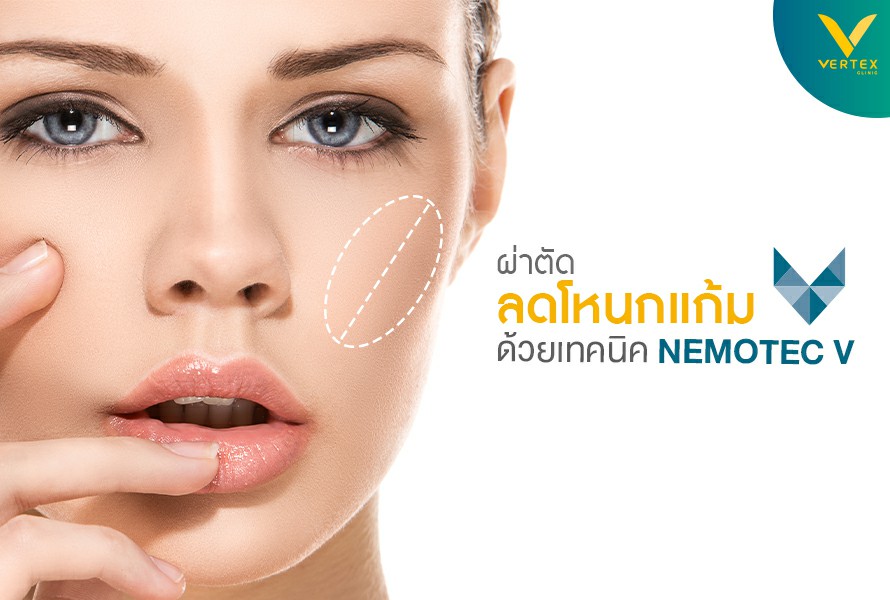 ผ่าตัดลดโหนกแก้ม