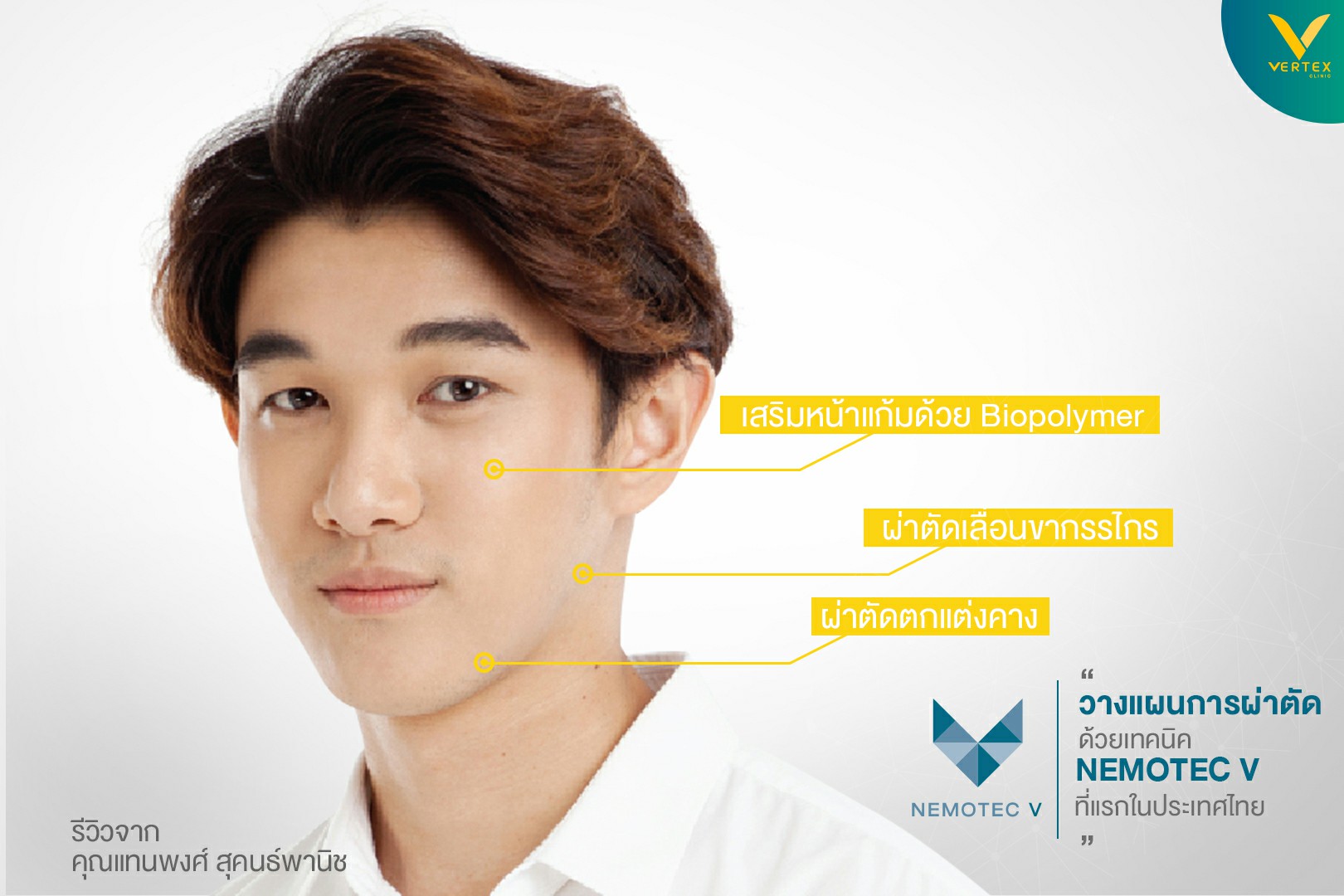 รีวิวศัลยกรรมปรับโครงหน้าจากคุณแทนพงษ์