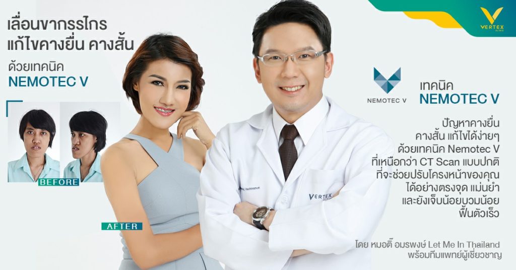 สุดยอดการผ่าตัดขากรรไกร แก้ปัญหาคางยื่น หน้ายื่น ด้วยเทคนิค Nemotec V