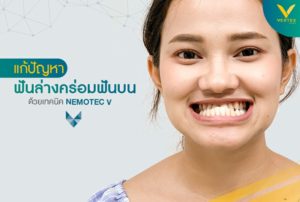 ผ่าตัดแก้ไขฟันล่างคร่อมฟันบน หนึ่งในปัญหาเกี่ยวกับขากรรไกร