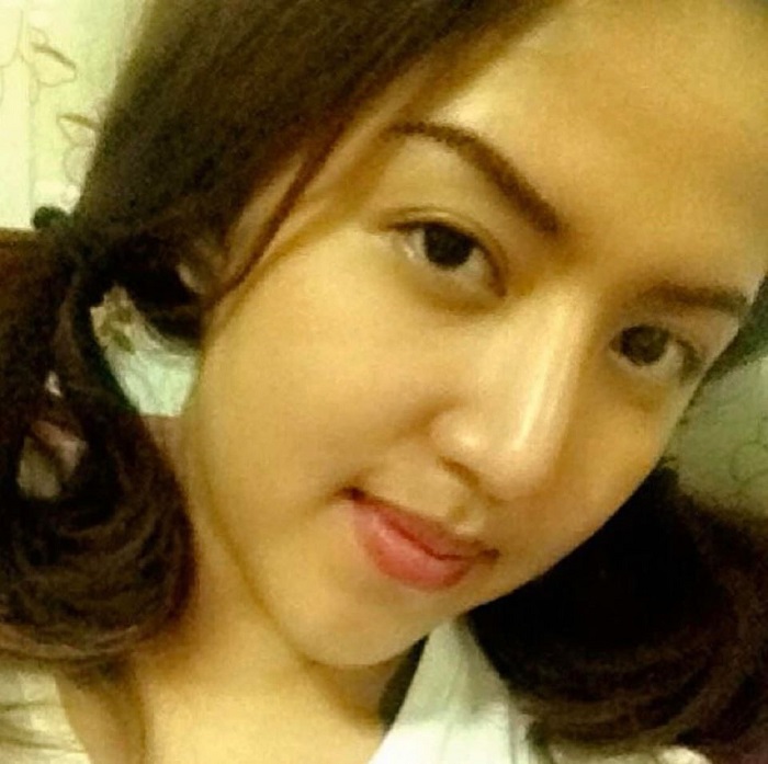 หลังศัลยกรรมจมูกและสักคิ้ว ใบหน้าเรีมเข้าที่ สวยขึ้นจนมีคนทัก