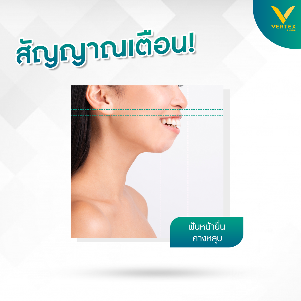 สัญญาณเตือน คางสั้น คางถอย
