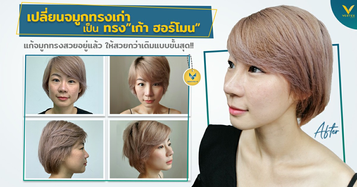 แก้ จมูก เจ็บ ไหม