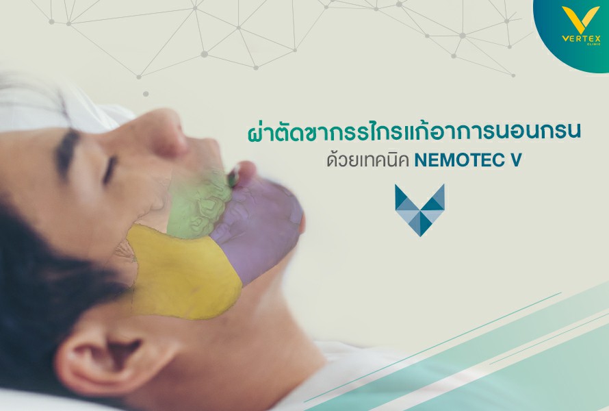ผ่าขากรรไกรแก้นอนกรน