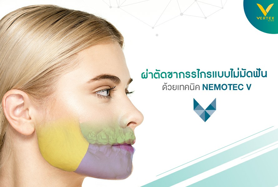 ผ่าตัดขากรรไกร แบบไม่มัดฟัน