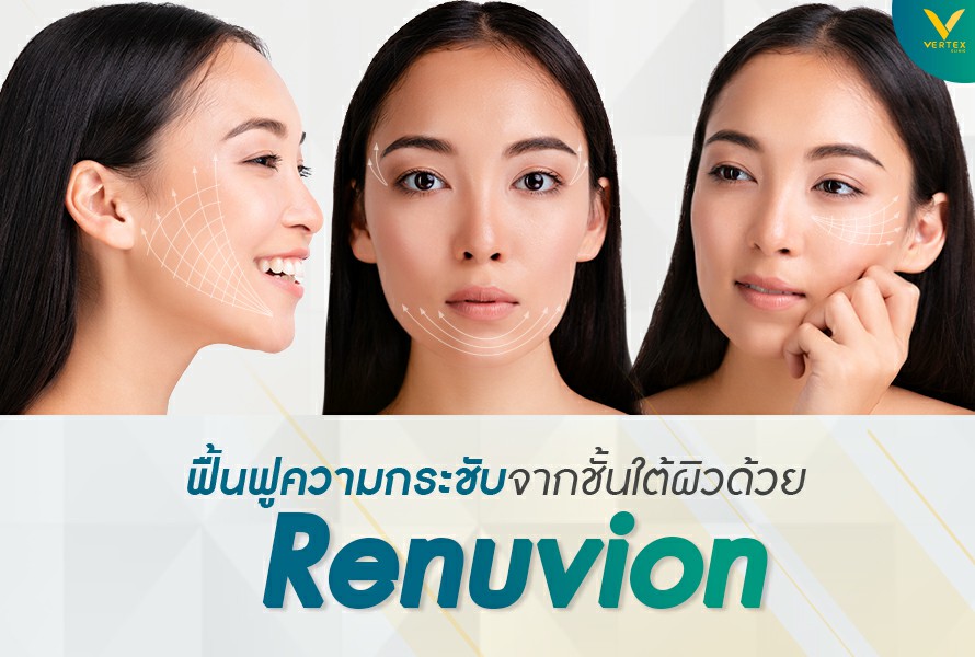 แก้ปัญหาผิวหนังหย่อนยาน ยกกระชับผิวหน้าและลำคอ ด้วย J-Plasma