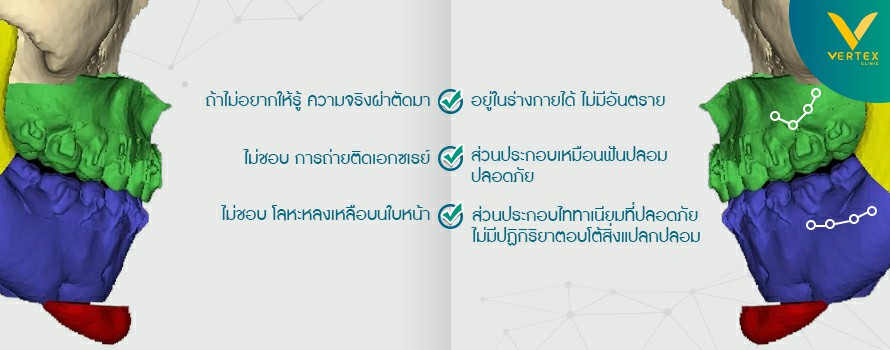 เปรียบเทียบความแตกต่างระหว่างผ่าหมุดและไม่ผ่าหมุดออกขากรรไกร