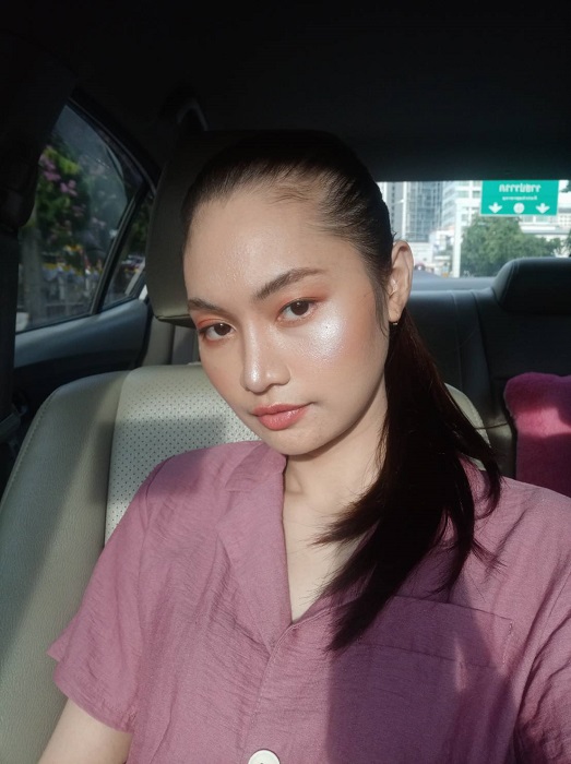 2 อาทิตย์ผ่านไป หลังจากผ่าตัดมุมกราม ใบหน้าสวยขึ้นมาก มุมกรามหายไปชัดเจน