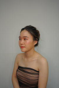 ภาพหลังจากผ่านไป 1 เดือน หลังจากผ่าตัดทำหน้าเรียว มุม 45 องศา