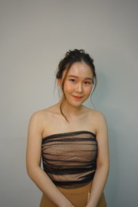 ภาพหลังจากผ่านไป 1 เดือน หลังจากผ่าตัดทำหน้าเรียว