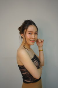 หลังจากผ่าตัดทำหน้าเรียว ภาพหลังจากผ่านไป 1 เดือน