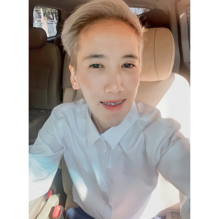 [รีวิวผ่าขากรรไกรร่วมกับจัดฟัน+ทำคาง] ปากอูมปากยื่น ต้องฝืนเคี้ยว เลื่อนขากรรไกร แก้ฟันเบี้ยว ครั้งเดียวจบ!