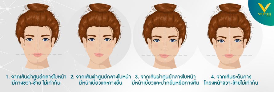 วิธีสังเกตุใบหน้าเบี้ยว