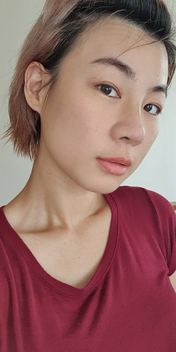 หลังทำการแก้จมูก วันที่ 6 ชอบมาก จมูกสวยขึ้นทุกวัน