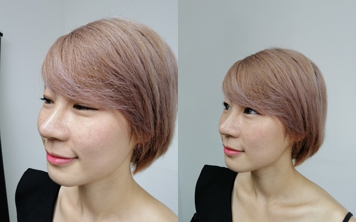 หลังทำการแก้จมูก ผ่านไปแล้ว 1 อาทิตย์ สวยเหมือนครบ 1 เดือนเลย