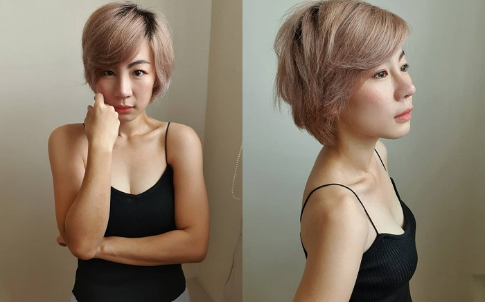 หลังทำการแก้จมูก ผ่านไปแล้ว 8 วัน รู้สึกว่าจมูกสวยขึ้นทุกวัน