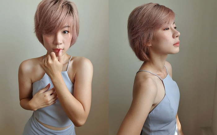 หลังทำการแก้จมูก ผ่านไปแล้ว 10 วัน รู้สึกว่าจมูกสวยขึ้นทุกวัน