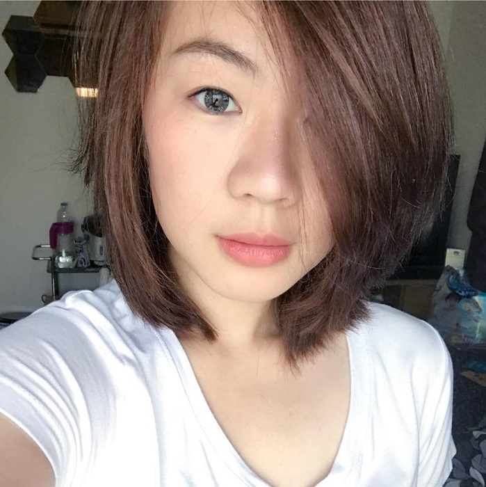 ภาพก่อนแก้จมูก (เสริมจมูกครั้งแรก)