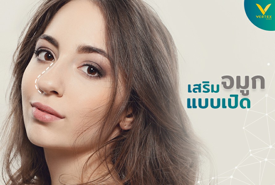เสริมจมูกเทคนิค Open เสริมจมูกแบบเปิด