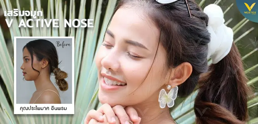 Nose-Surgery-Review-Prapaimas
