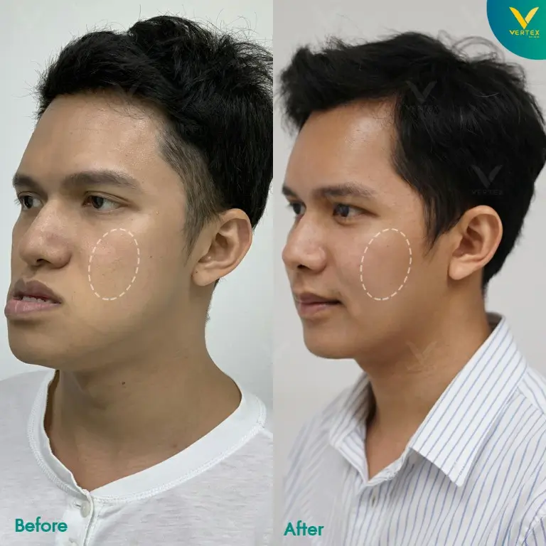 Review-Cheek-Biopolymer