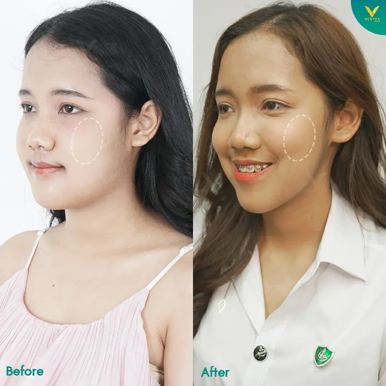 Review-Cheek-Biopolymer