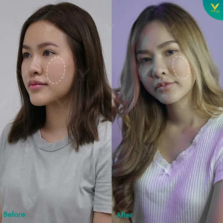 Review-Cheek-Biopolymer