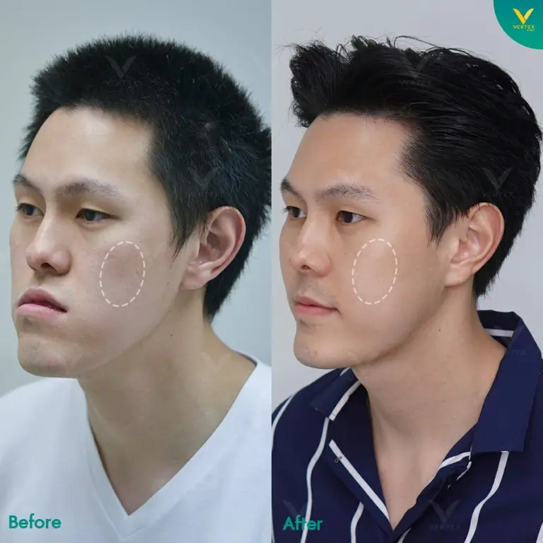 Review-Cheek-Biopolymer