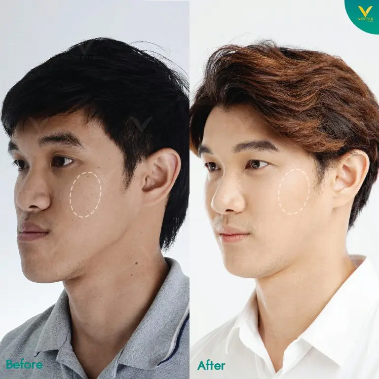 Review-Cheek-Biopolymer