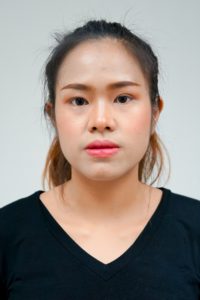 หน้าก่อนตัดโหนก ตัดกราม ผ่าขากรรไกร คุณจินตหรา