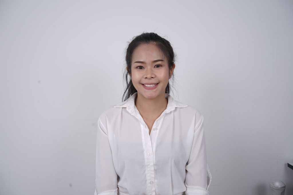รีวิวหลังตัดโหนกแก้ม ผ่าขากรรไกร ตัดกราม 1 เดือน คุณจินตหรา
