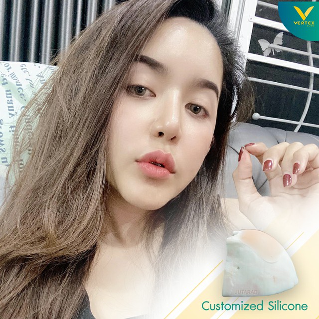 หน้าผากสวยด้วยซิลิโคนเฉพาะบุคคล รีวิวจากคุณจุฑารัตน์