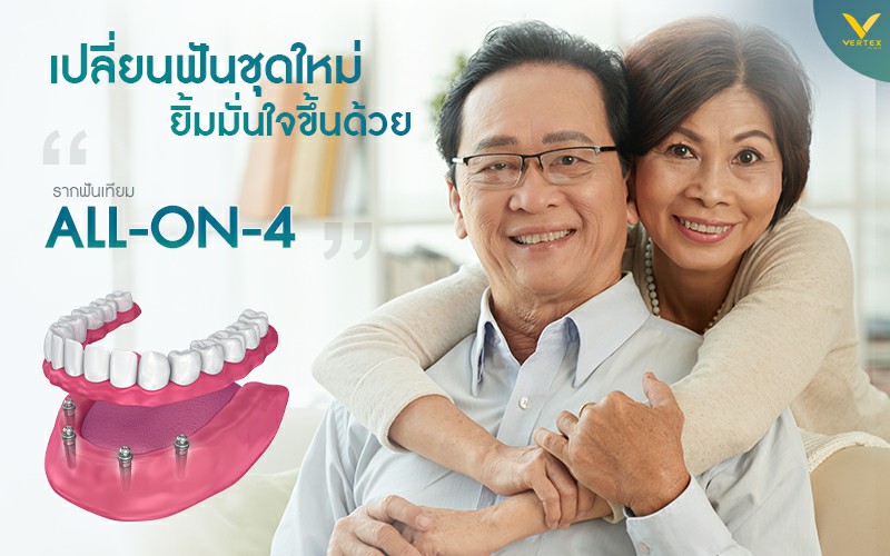 เปลี่ยนฟันใหม่ถาวร ทดแทนฟันหายทั้งปากด้วยรากฟันเทียม All-On-4
