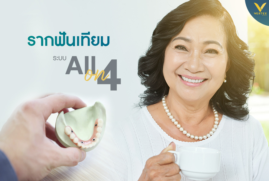 รากฟันเทียม All-On-4 ทดแทนฟันหายทั้งปาก ได้ฟันใหม่ไม่ต้องทำฟันปลอมอีกต่อไป