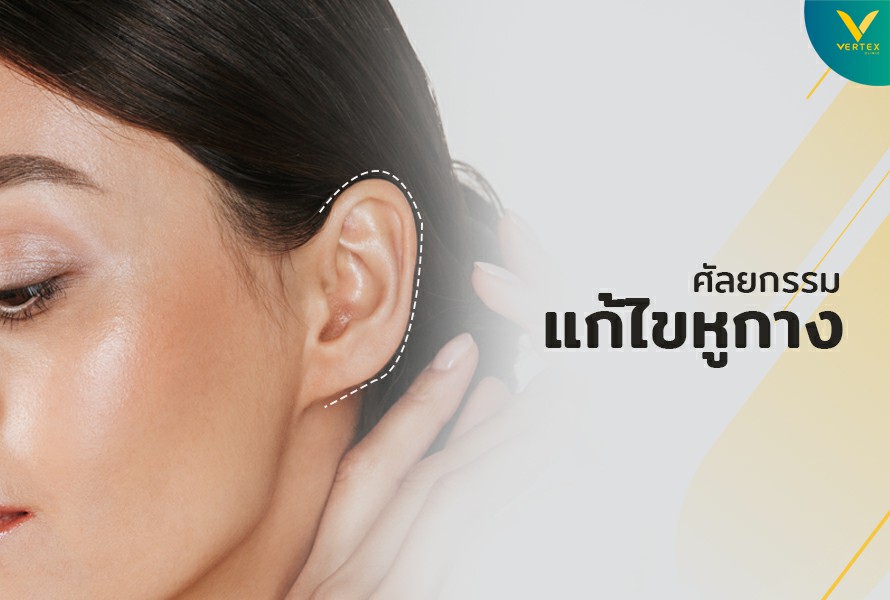 ศัลยกรรมแก้ไขหูกาง
