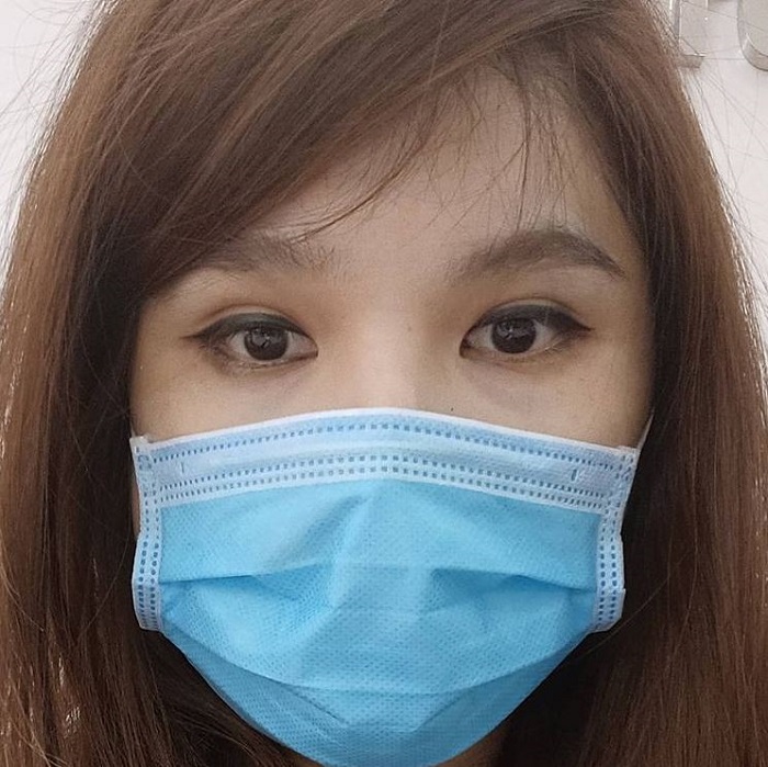 [รีวิวทำคาง+ตัดกราม+ทุบโหนก]ทุบทั้งหน้า!!