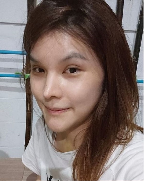[รีวิวทำคาง+ตัดกราม+ทุบโหนก]ทุบทั้งหน้า!!