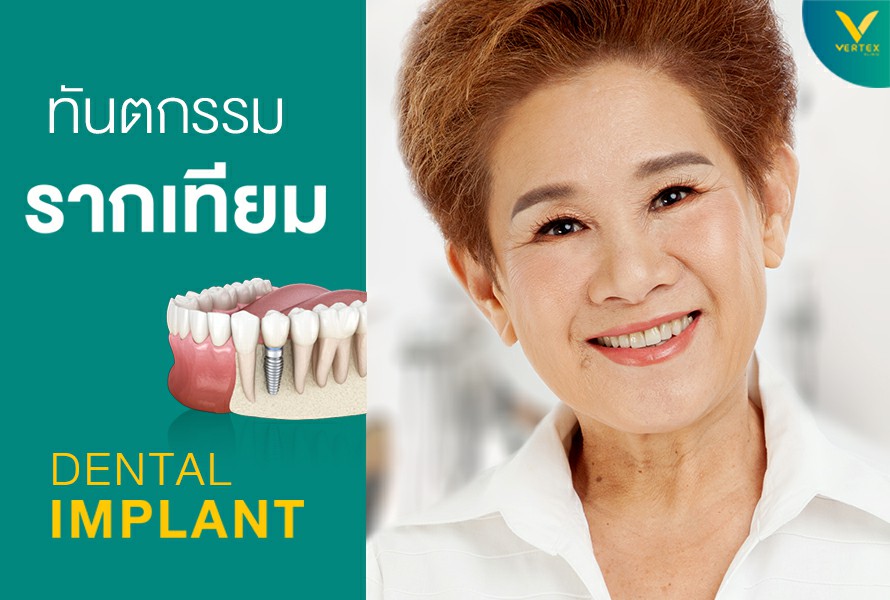 ทันตกรรมรากฟันเทียม