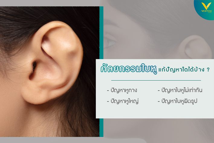 ศัลยกรรมแก้ไขหูกาง