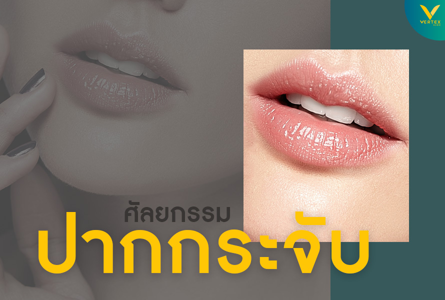 ศัลยกรรมปากกระจับ