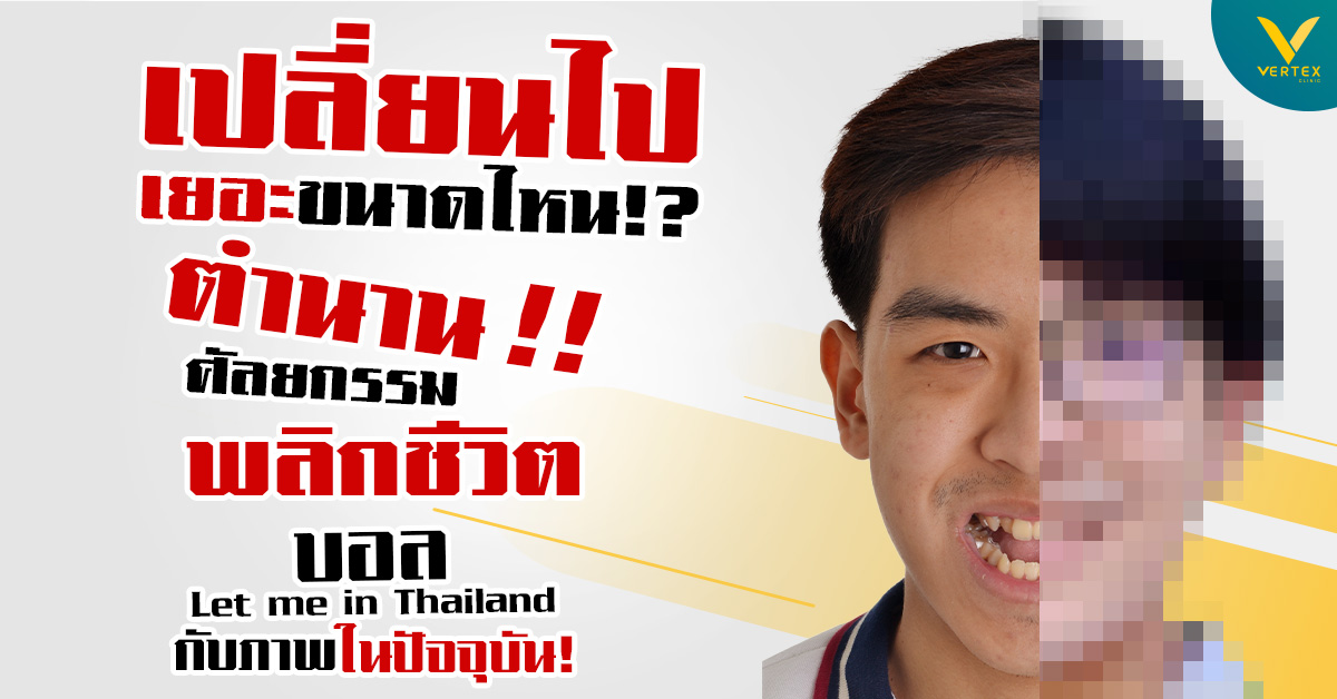 เปลี่ยนไปเยอะขนาดไหน!? ศัลยกรรมพลิกชีวิต บอล Let me in Thailand กับภาพในปัจจุบัน
