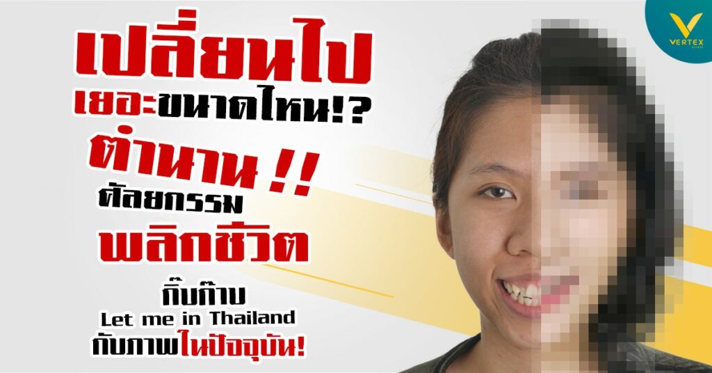 กิ๊บก๊าบ let me in Thailand อัปเดตหลังศัลยกรรมโครงหน้า แก้คางสั้น ปากอูม
