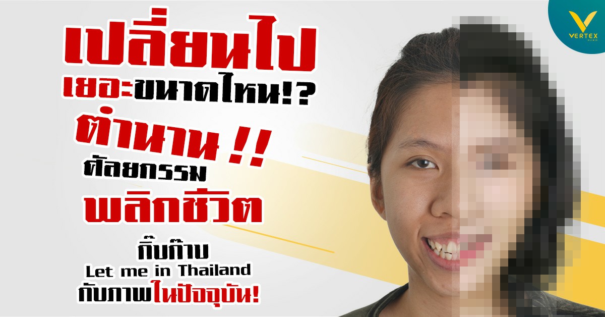 เปลี่ยนไปเยอะขนาดไหน!? ศัลยกรรมพลิกชีวิต กิ๊บก๊าบ Let me in Thailand กับภาพในปัจจุบัน