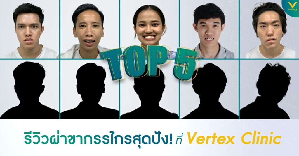 ผ่าตัดขากรรไกรรีวิวจริง รีวิวผ่าตัดขากรรไกรจากคนไข้