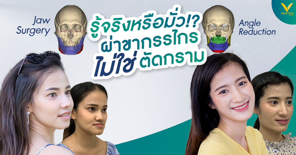 ผ่าขากรรไกร แก้ขากรรไกรยื่น ไม่ใช่ตัดกราม เหลากราม