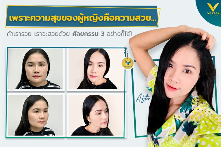 [รีวิวตัดกราม+ทำคาง+ตัดไขมันกระพุ้งแก้ม]