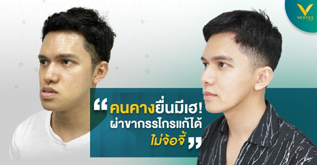 แก้คางยื่น ขากรรไกรยื่น ฟันไม่สบกัน ผ่าตัดขากรรไกร
