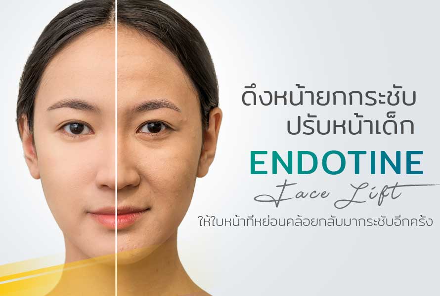 ยกหน้า ยกกระชับหน้า ดึงหน้า ปรับรูปหน้า ดึงหน้าที่ไหนดี